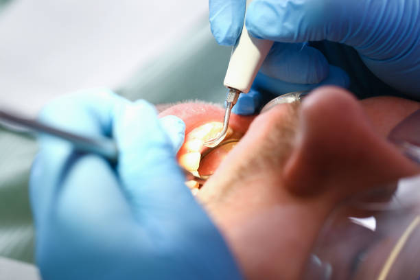 Best Weekend Emergency Dentist in Coleman, TX