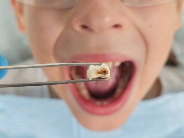Best Pediatric Emergency Dentist in Coleman, TX